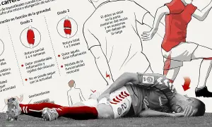 Ilustración sobre lesiones de isquiotibiales, mostrando grados de rotura y un deportista con dolor.
