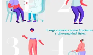 Atrofia muscular en las piernas: causas, síntomas y tratamientos efectivos