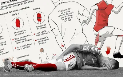 Ilustración sobre lesiones de isquiotibiales, mostrando grados de rotura y un deportista con dolor.