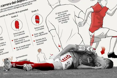 Ilustración sobre lesiones de isquiotibiales, mostrando grados de rotura y un deportista con dolor.
