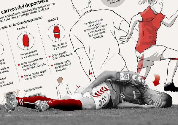 Ilustración sobre lesiones de isquiotibiales, mostrando grados de rotura y un deportista con dolor.
